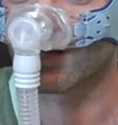 Respiratory Therapy May Lower Death Risk for Some Sleep Apnea Patients