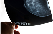 'Freezing' Technique May Work for Some Women With Early Breast Cancer