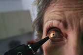 Animal Trials Show Promise for Treating Eye Cancer