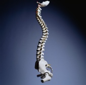 Genes Tied to Curvature of Spine in Kids