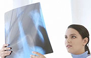 Common Respiratory Diseases Tied to Lung Cancer Risk
