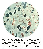 Leprosy Still Occurs in U.S., CDC Reports