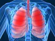 Lung Transplants From Heavy Drinkers Linked to Higher Complication Risk