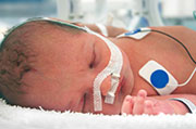 More Extreme Preemies Are Surviving, Study Finds