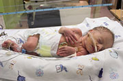 Certain Genes in Babies May Up Preterm Birth Risk