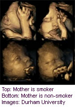 Fetal Faces Seem to React to Mom's Smoking