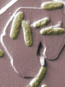 Antibiotic-Resistant Typhoid Spreading Across Asia, Africa
