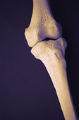 Targeted Workouts May Strengthen Men's Bones in Middle Age