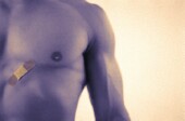 More Men With Breast Cancer Having Second Breast Removed