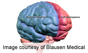 Study Challenges Theory About Left Brain/Right Brain Behavior