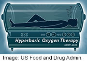 Hyperbaric Oxygen Chambers Aren't Cure-Alls, FDA Warns