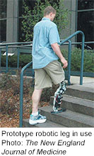 New Robotic Leg Gets Closer to the Real Thing, Study Says