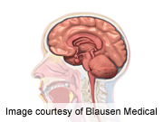 Stutterers Show Different Brain Development, Study Says