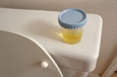 Urine Test May Spot Heart, Kidney Risk in Kids With Type 1 Diabetes