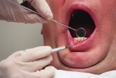 Typical Gum Disease Treatments Won't Help Ease Diabetes, Study Finds