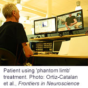 Amputee's 'Phantom Limb' Pain Eased by Virtual Arm Technology