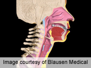 Treatment May Prevent Esophagus Condition From Progressing to Cancer