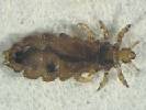 Head Lice Growing Resistant to Standard Meds
