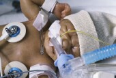 Gut Bacteria in Preemies Could Lead to Life-Threatening Infections