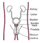 Surgery May Benefit Younger Prostate Cancer Patients