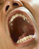 Low-Power Laser May Trigger Tooth Repair