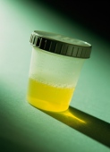 'Sterile' Urine May Be a Myth