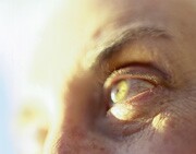 Failing Vision Tied to Shorter Lifespans for Seniors