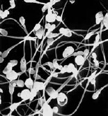 Sperm's Anti-Germ 'Shield' Might Play Role in Fertility