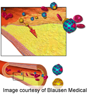 Experimental Cholesterol-Lowering Drug Effective, Study Reports