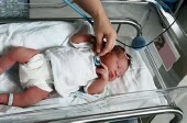 Preterm-Birth Complications Leading Global Killer of Young Children