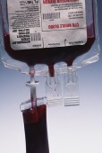 Patients Given Less Blood During Surgery Do Fine, Study Reports