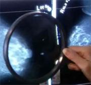 Preliminary Studies Target Advanced Breast Cancers