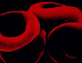 Iron Supplements May Help Blood Donors Recover More Quickly