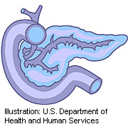 Study Probes Use of MRI to Spot Pancreatic Cancer in High-Risk Patients