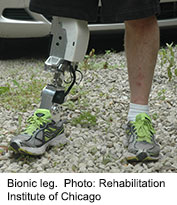 Technology Offers Hope of Better Bionic Legs