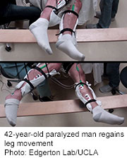 Noninvasive Stimulation Gets Legs Moving After Spinal Cord Injury